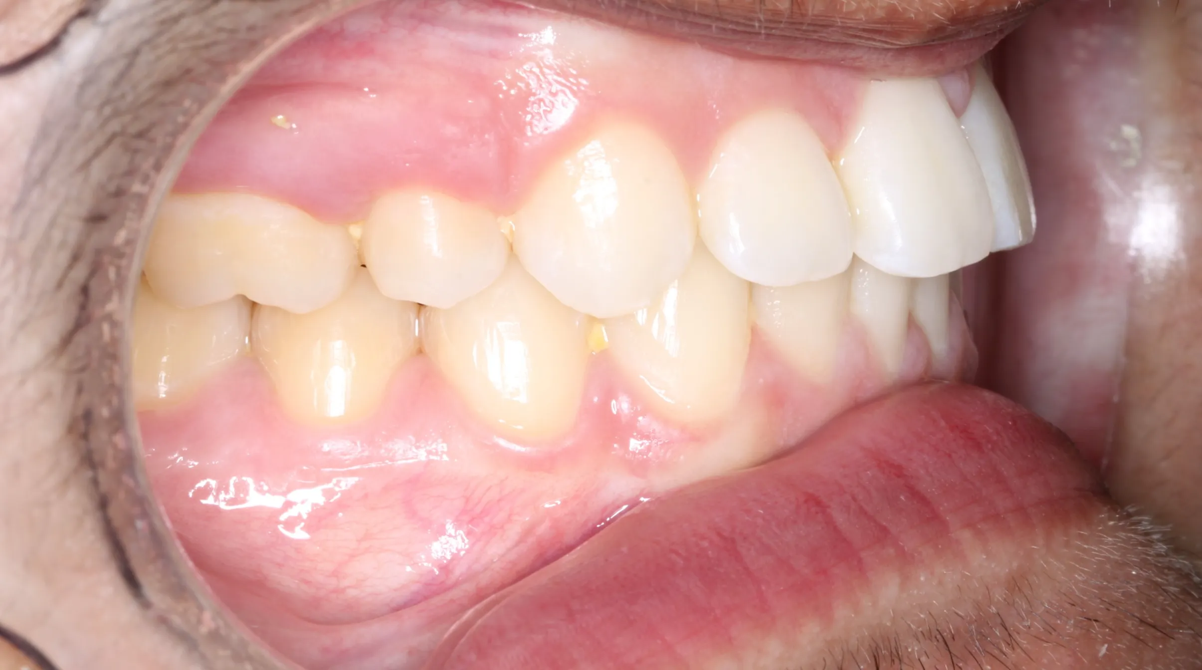 smile-gallery gallery